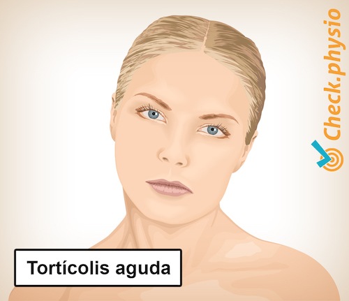 cuello tortícolis cuello torcido postura con desviación