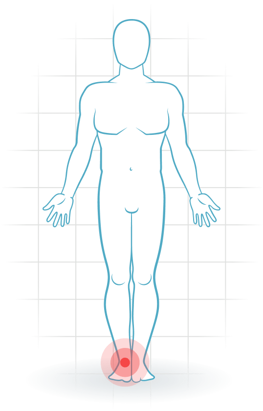pijnlocatie Inestabilidad del tobillo